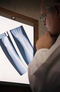 Doctor examining x-ray
