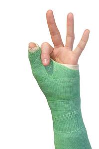 Arm in a cast