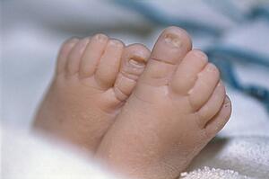 Newborn feet