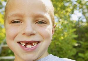 Smiling boy missing teeth