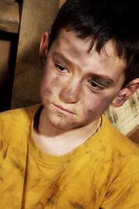 Impoverished boy