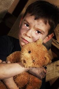 Impoverished boy