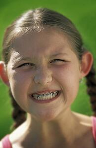 Girl with funny smile