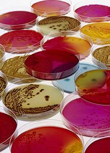 Petri dishes with Bacteria