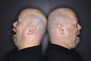 Bald mid adult identical twin men standing back to back with sad expressions.