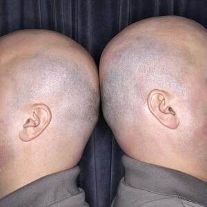 Close up of bald identical twin men standing back to back.