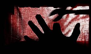 Mutilated finger