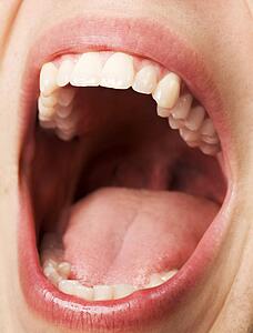 Open mouth