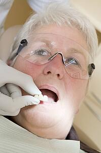 Dentist in exam room fitting dentures on woman in chair