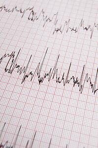 ECG print out