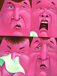 Allergy