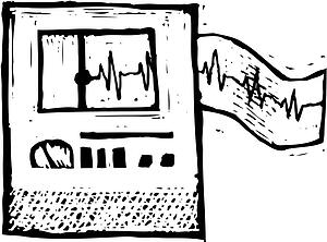 EKG