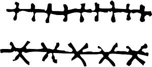 Stitches