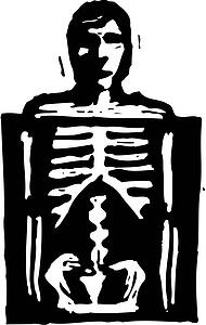 X-Ray Guy