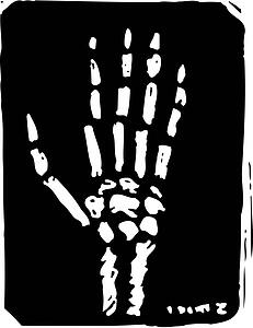 X-Ray Hand